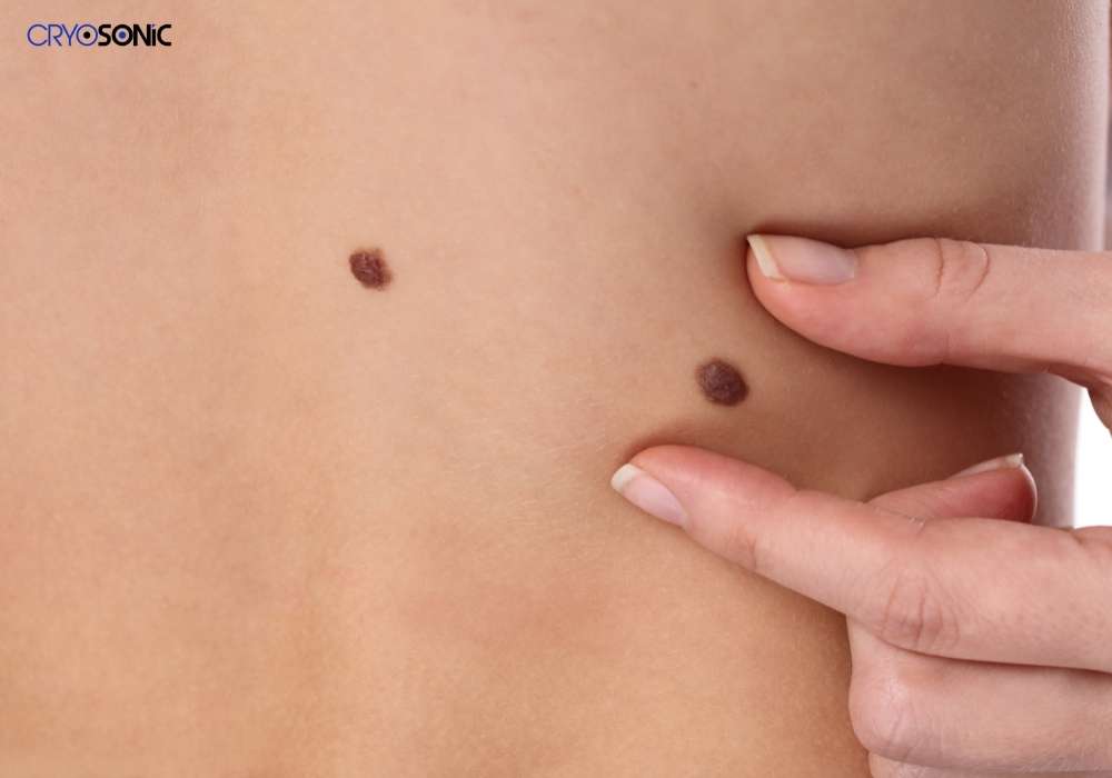Infection Risk and Poor Aftercare Hemel Hempstead