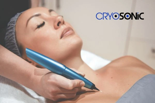 Cryosonic lesion removal prices book today! Hemel Hempstead