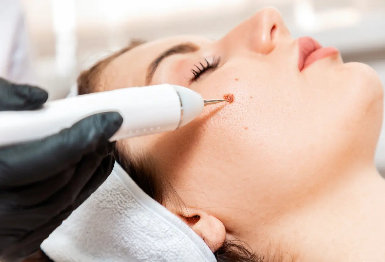 Frequently Asked Questions About Multiple Cryotherapy Treatments Hemel Hempstead