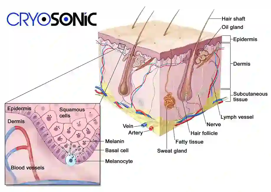 How Cryotherapy Stimulates Melanocyte Activity  Hemel Hempstead